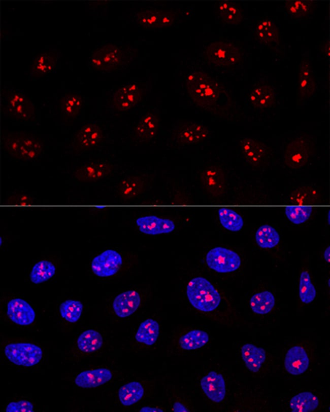 100UL MYBBP1A ANTIBODY 100 ul