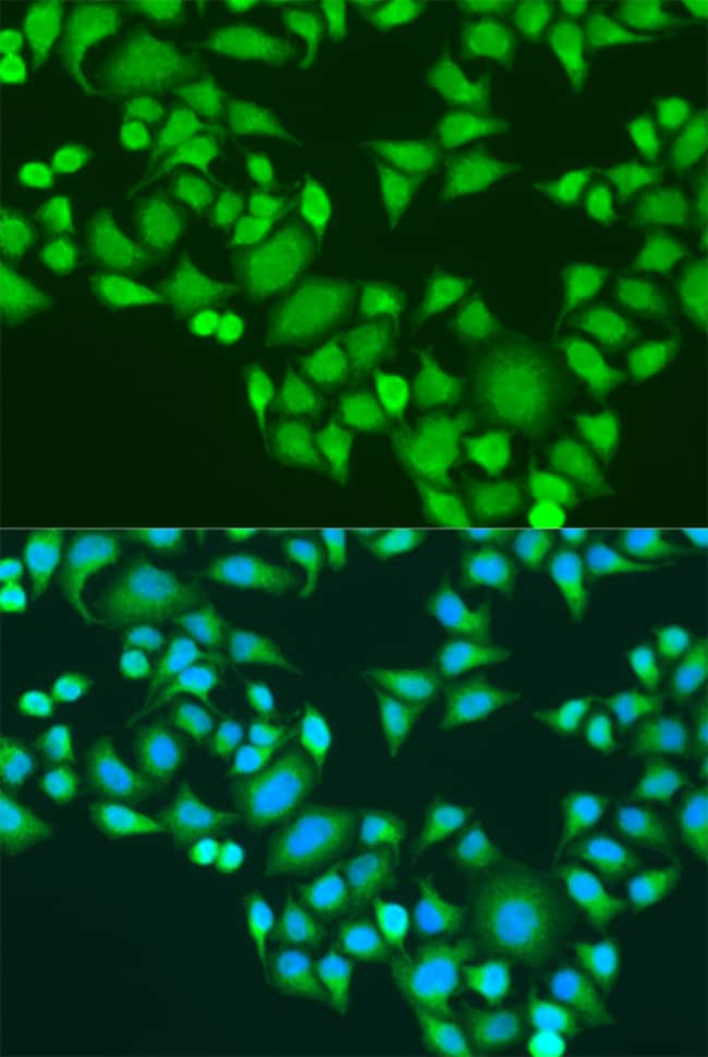 100UL IGF2BP3 ANTIBODY 100 ul