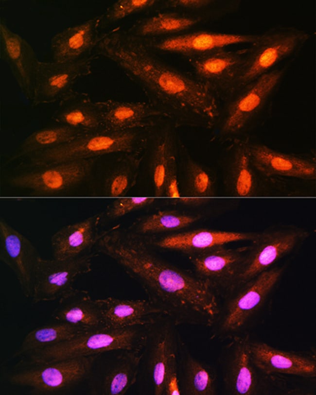 100UL KAP3 ANTIBODY 100 ul