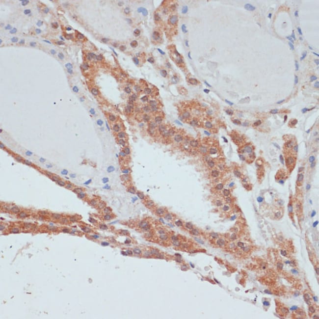 100UL MYCBP ANTIBODY 100 ul