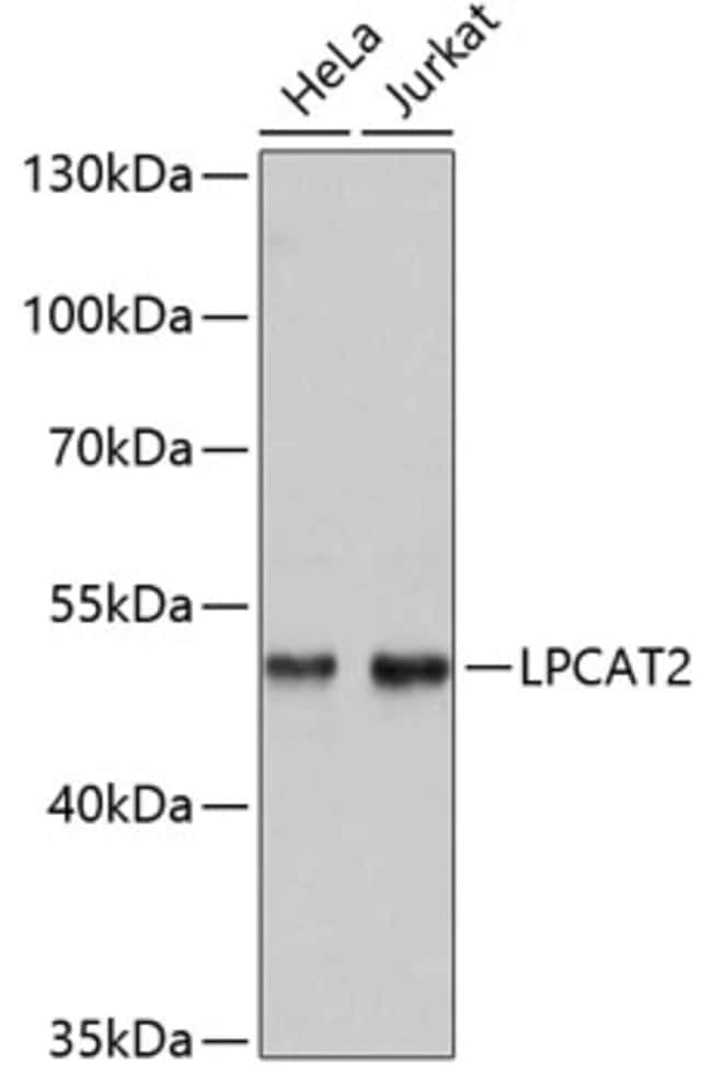 100UL LPCAT2 ANTIBODY 100 ul