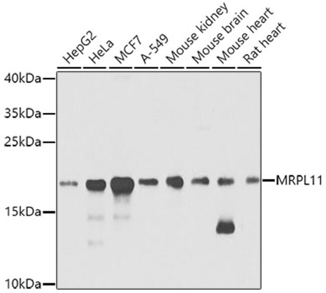 100UL MRPL11 ANTIBODY 100 ul