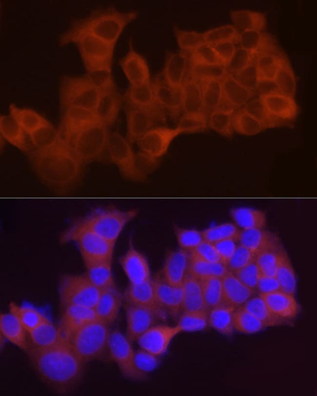 100UL LPCAT1 ANTIBODY 100 ul