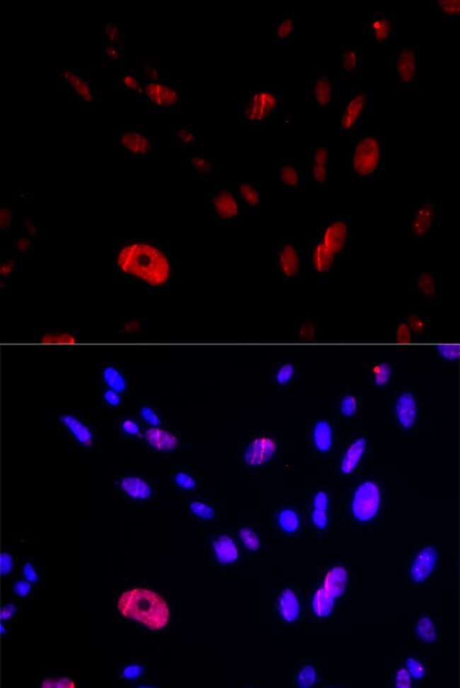 100UL HUS1 ANTIBODY 100 ul