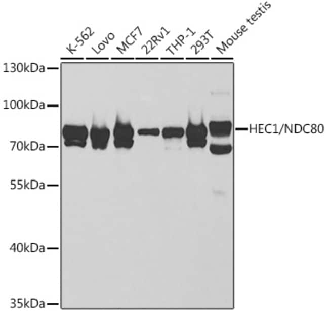 100UL HEC1 ANTIBODY 100 ul