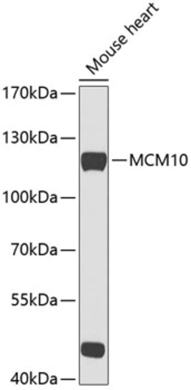 100UL MCM10 ANTIBODY 100 ul