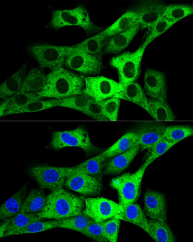 100UL GARS ANTIBODY 100 ul