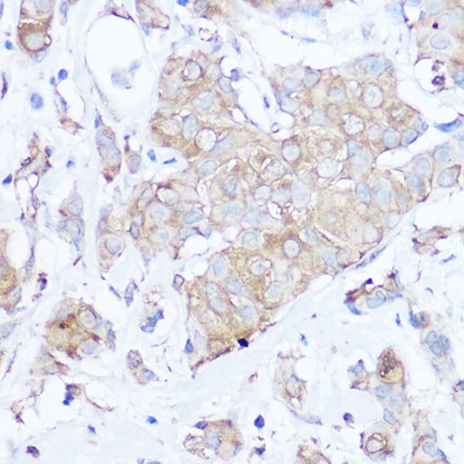 100UL MGP ANTIBODY 100 ul