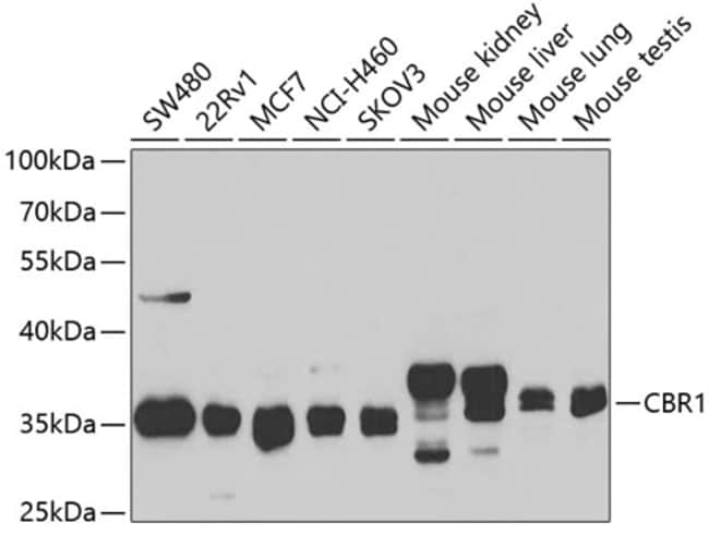 100UL CBR1 ANTIBODY 100 ul