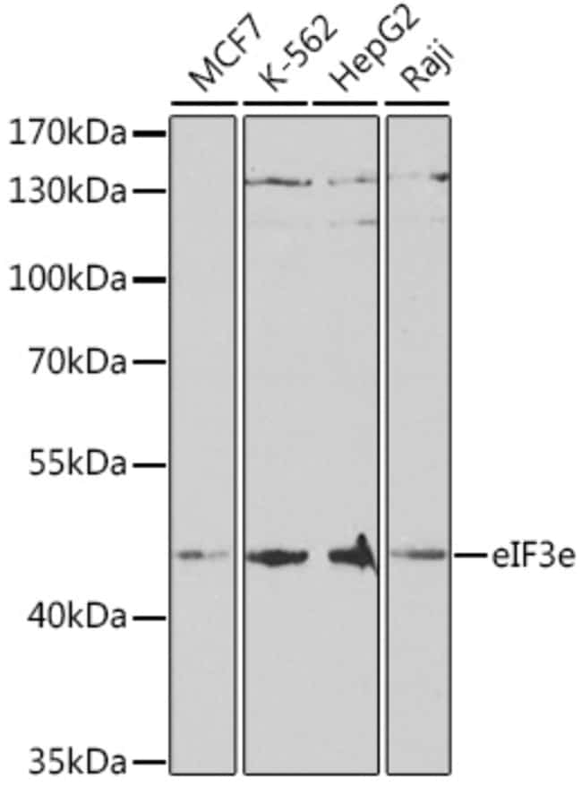 100UL EIF3E ANTIBODY 100 ul
