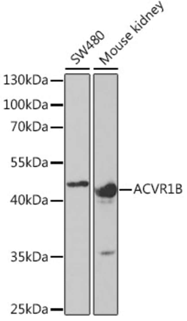 100UL ACVR1B ANTIBODY 100 ul
