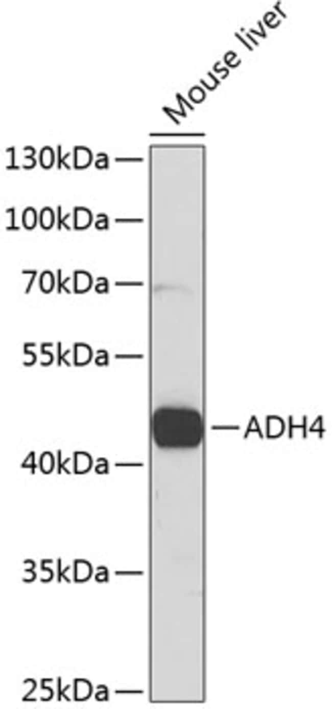 100UL ADH4 ANTIBODY 100 ul