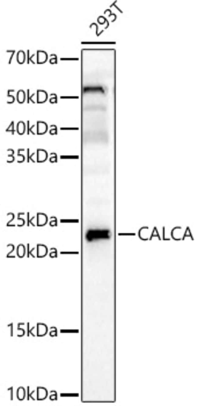 100UL APRT ANTIBODY 100 ul