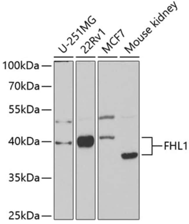 100UL FHL1 ANTIBODY 100 ul