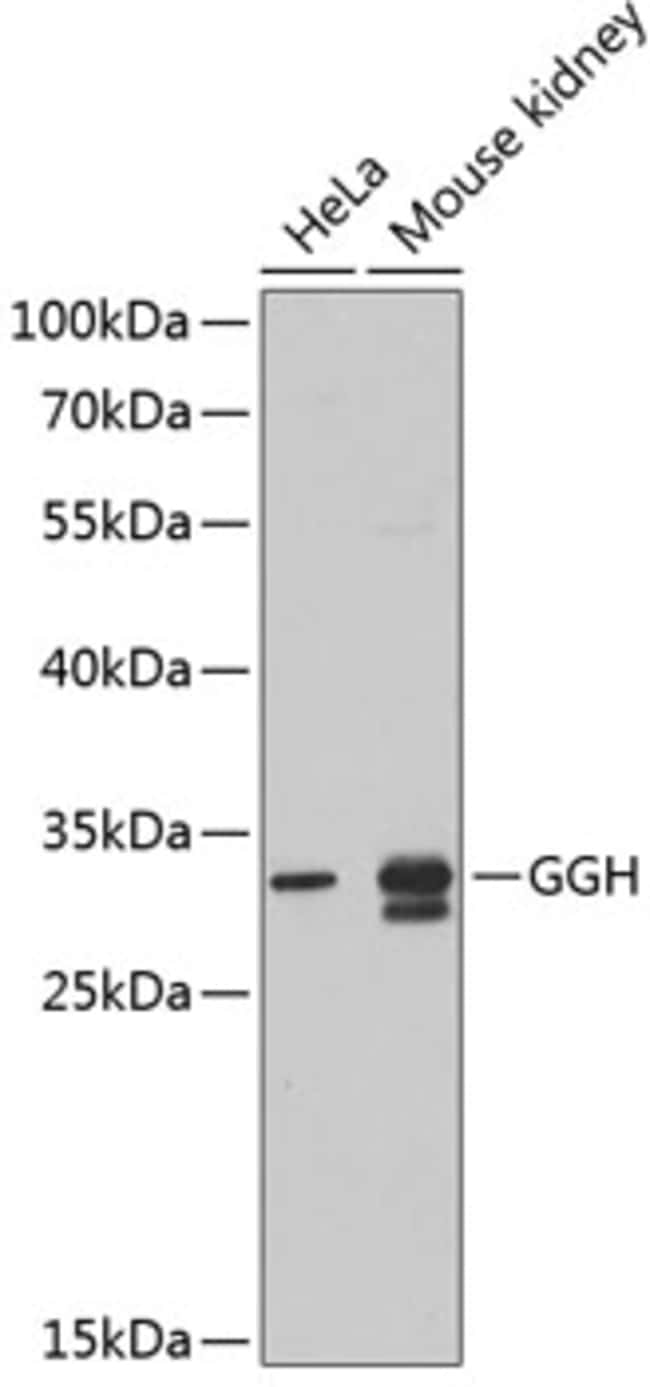 100UL GGH ANTIBODY 100 ul