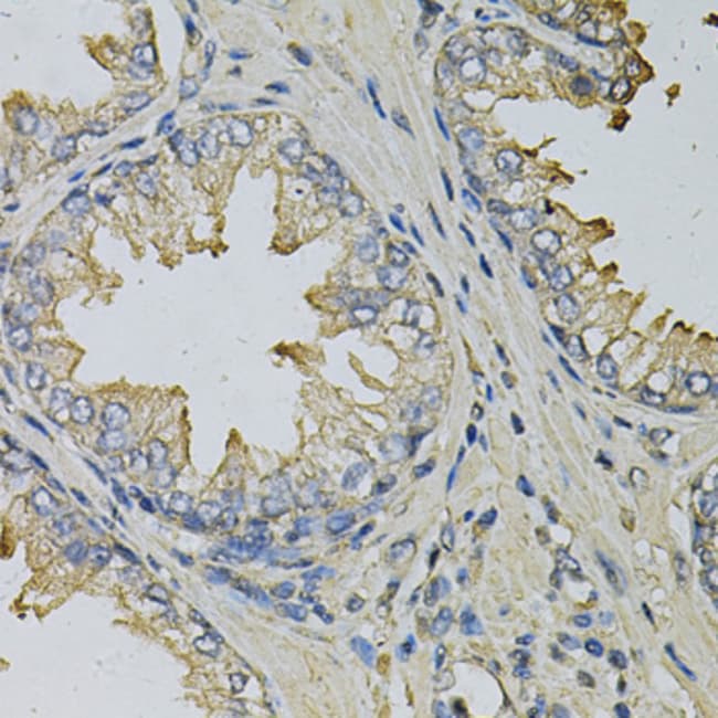 100UL LITAF ANTIBODY 100 ul