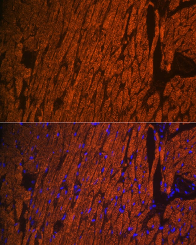 100UL MYL2 ANTIBODY 100 ul