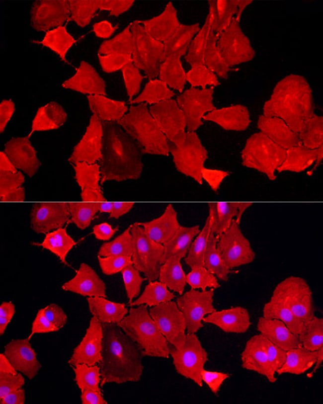100UL ALDH3A1 ANTIBODY 100 ul