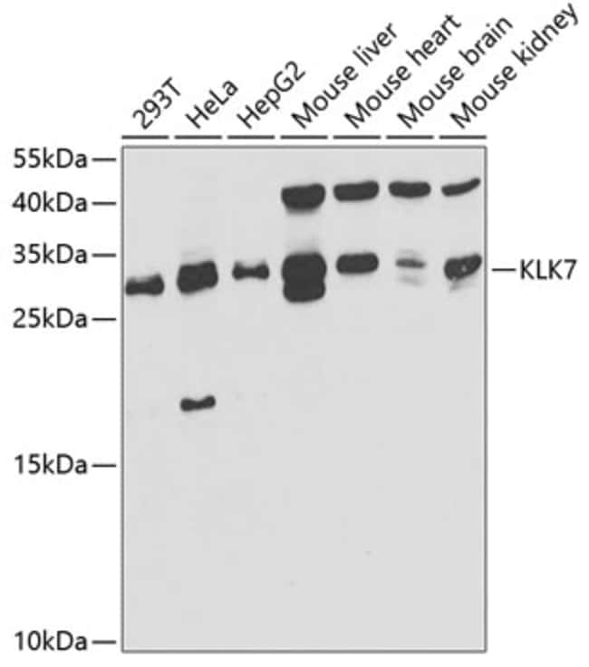 100UL KALLIKREIN 7 ANTIBODY 100 ul