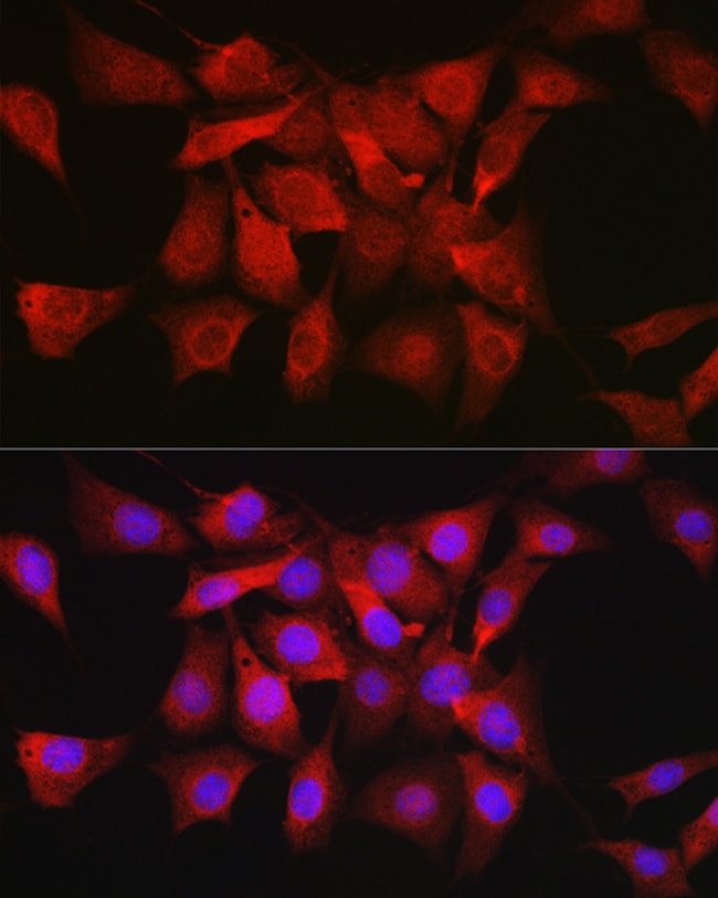 100UL AKT1 ANTIBODY 100 ul