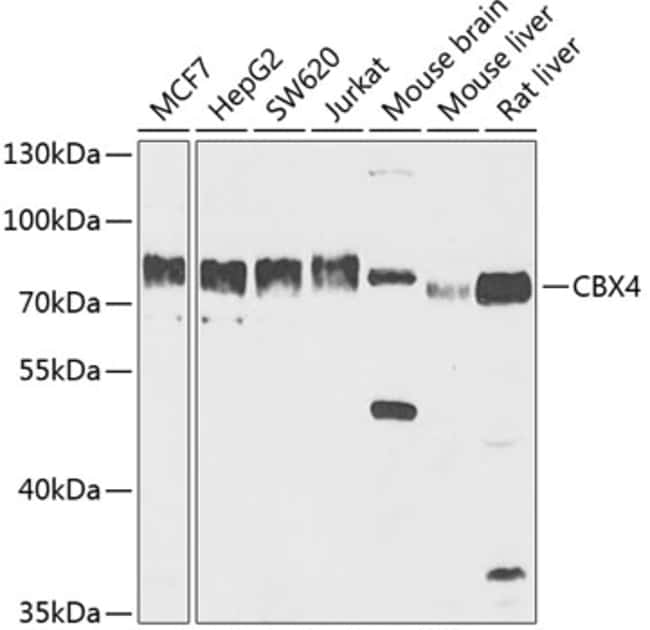 100UL CBX4 ANTIBODY 100 ul
