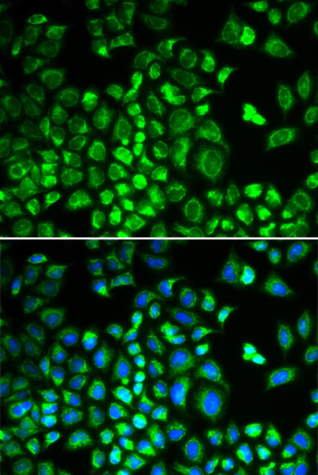 100UL HAX1 ANTIBODY 100 ul