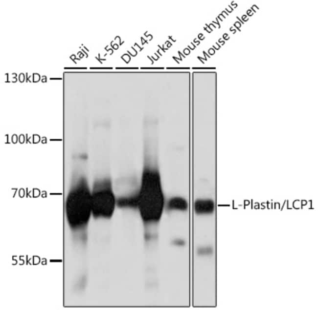 100UL L-PLASTIN ANTIBODY 100 ul