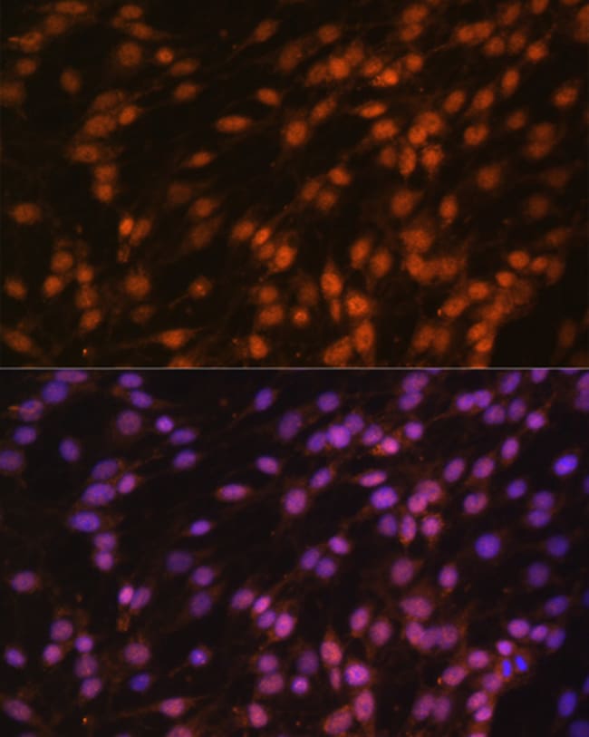 100UL FUBP1 ANTIBODY 100 ul