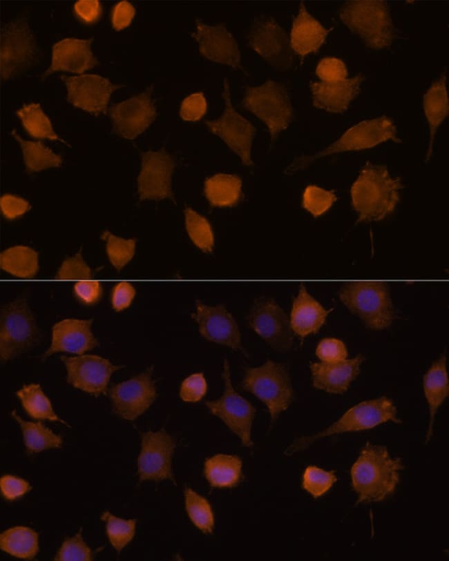 100UL ICAM-1 ANTIBODY 100 ul