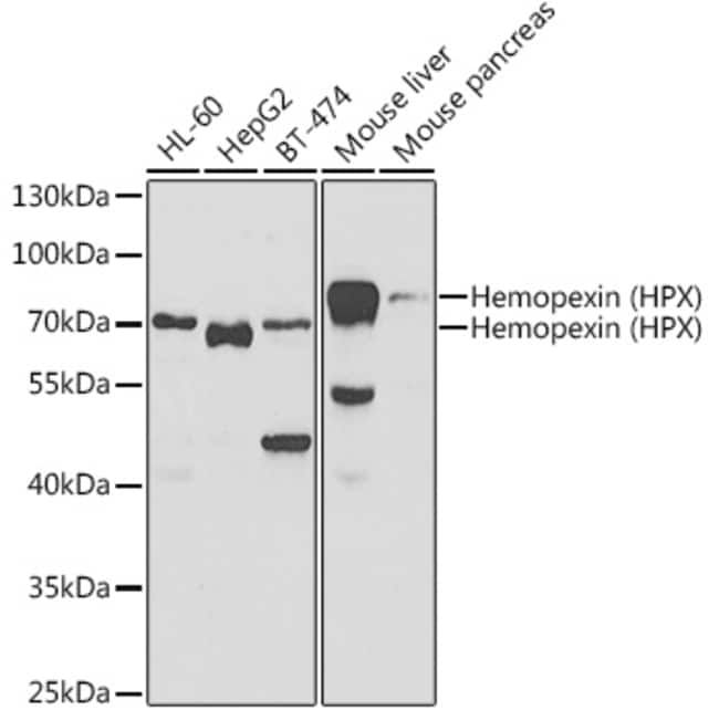 100UL HEMOPEXIN ANTIBODY 100 ul