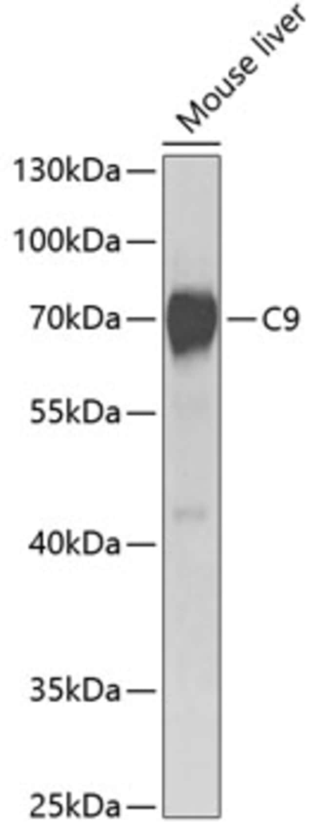 100UL COMPLEMENT C9 ANTIBODY 100 ul