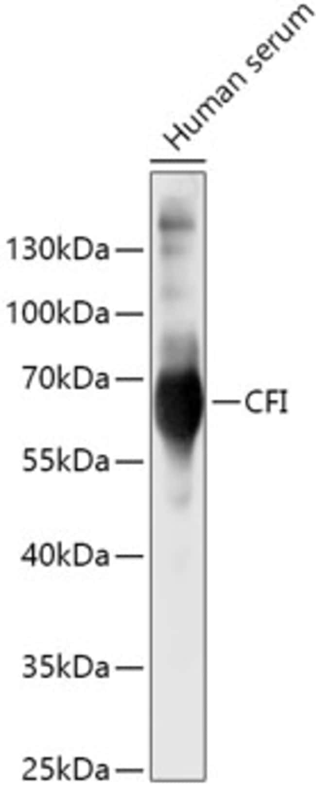 100UL COMPLEMENT FACTOR I ANTIBODY 100 u