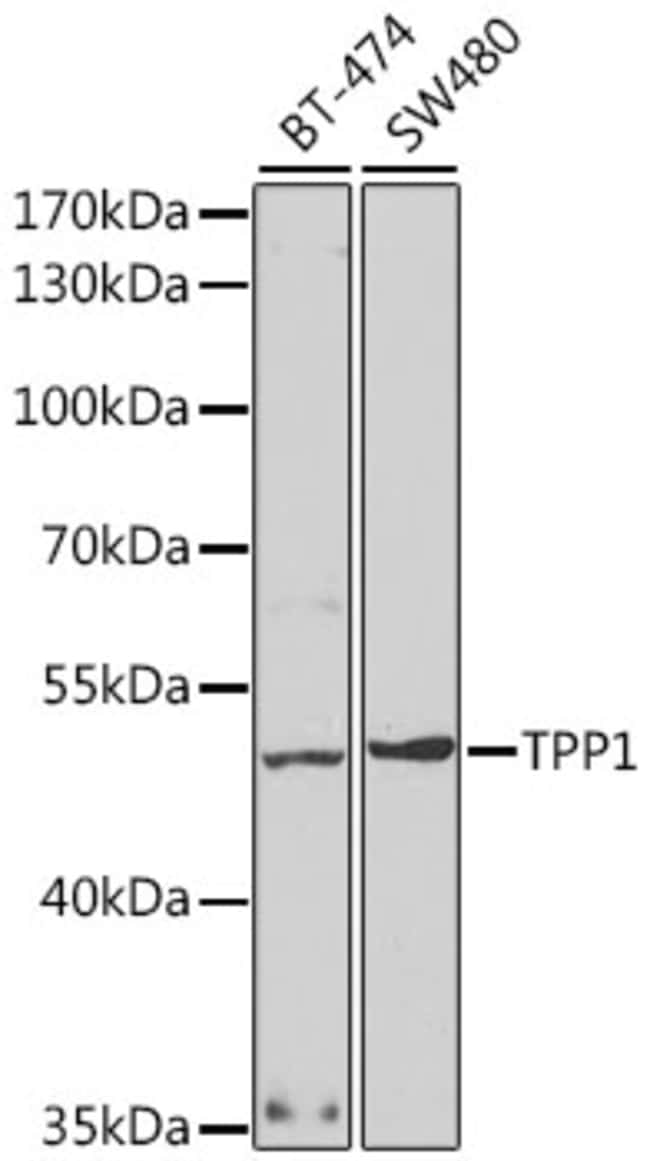 100UL CLN2 ANTIBODY 100 ul