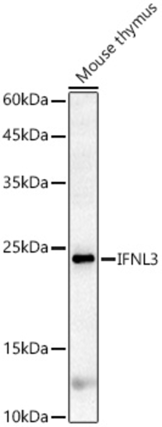 100UL IL-28B ANTIBODY 100 ul