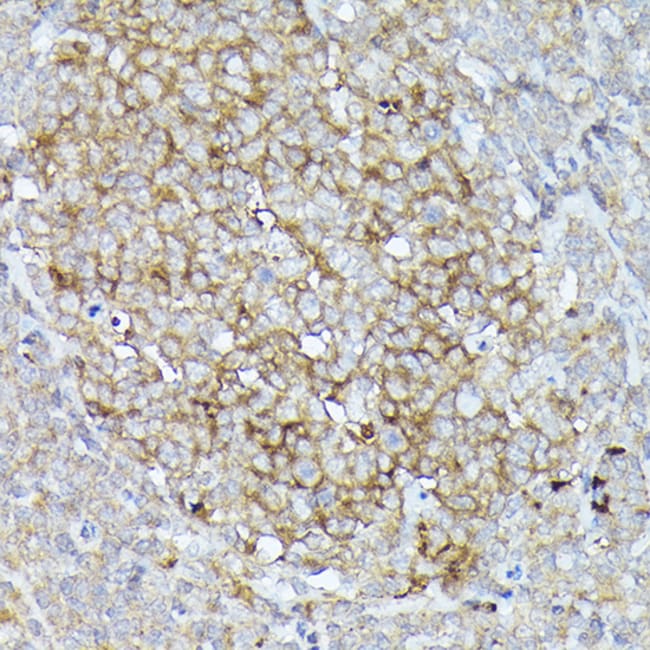 100UL CD10 ANTIBODY 100 ul