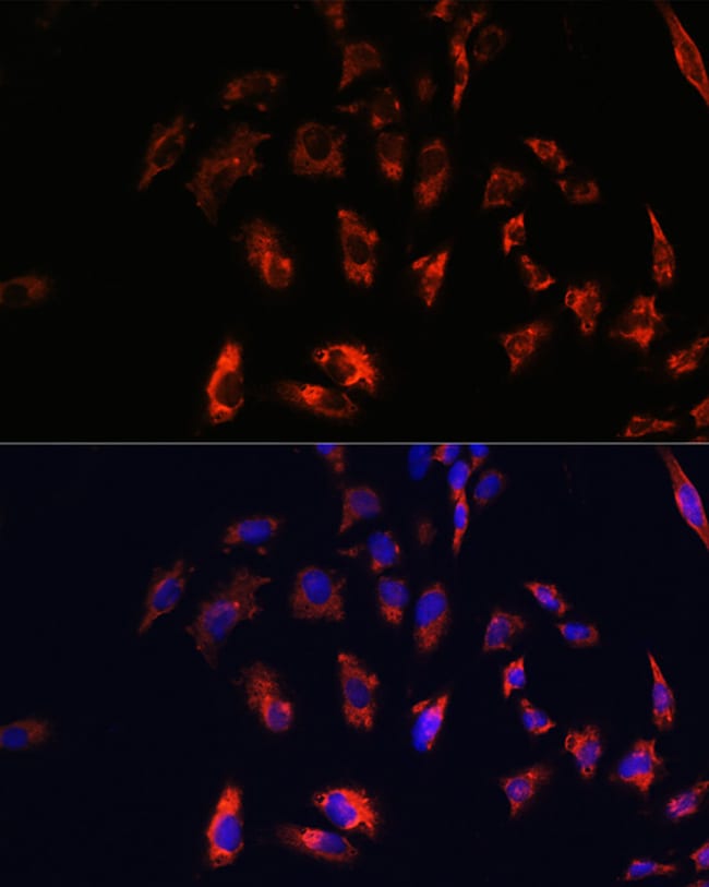 100UL CD74 ANTIBODY 100 ul