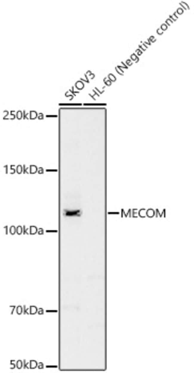 100UL EVI1 ANTIBODY 100 ul