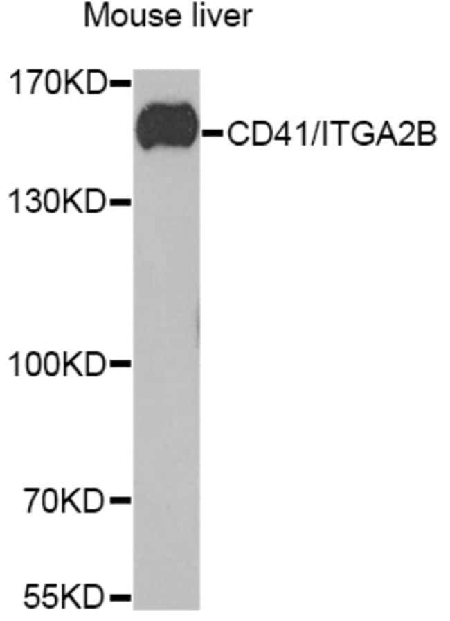 100UL CD41 ANTIBODY 100 ul