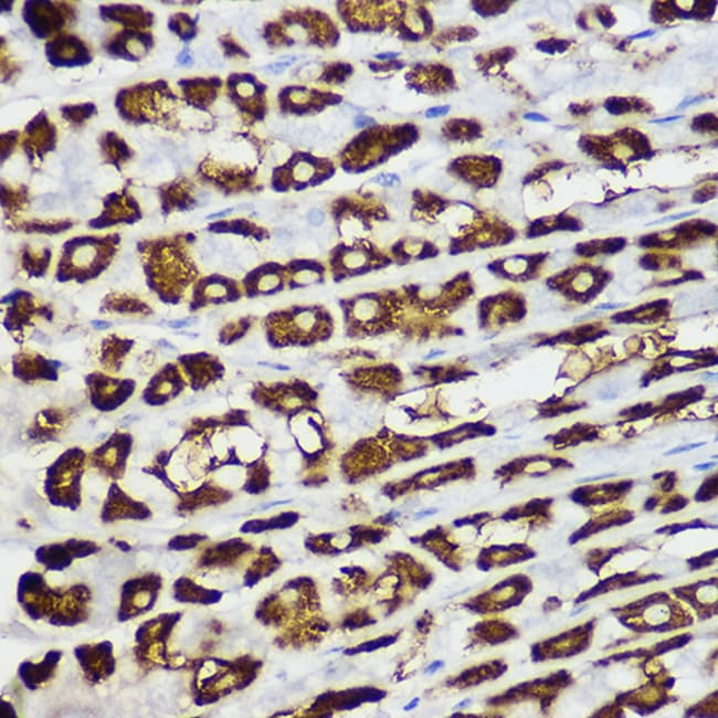 100UL BNIP3 ANTIBODY 100 ul
