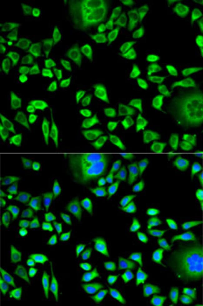 100UL CYSTATIN A ANTIBODY 100 ul