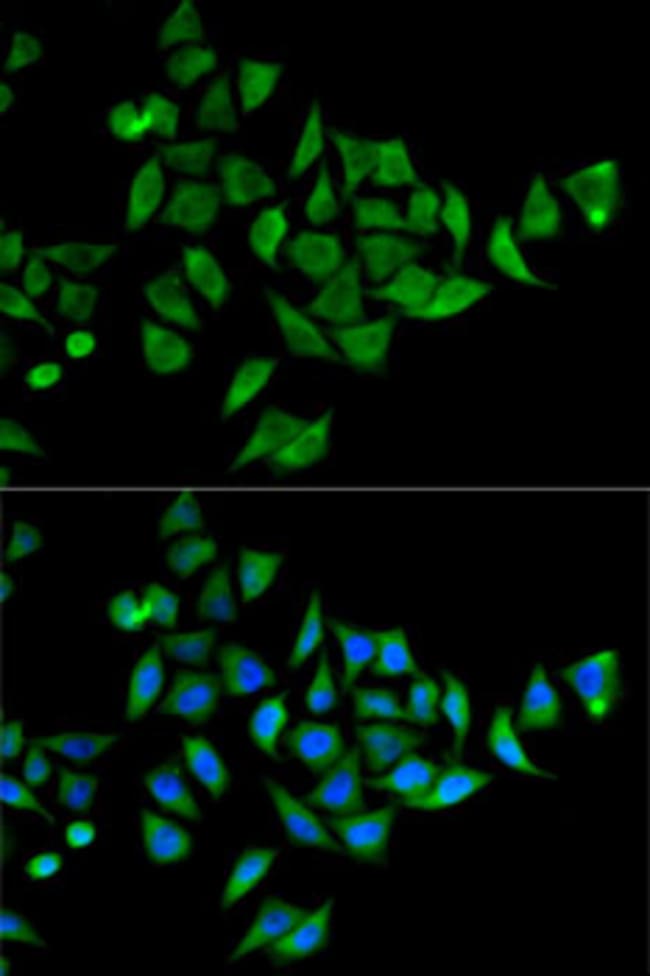 100UL DOK1 ANTIBODY 100 ul