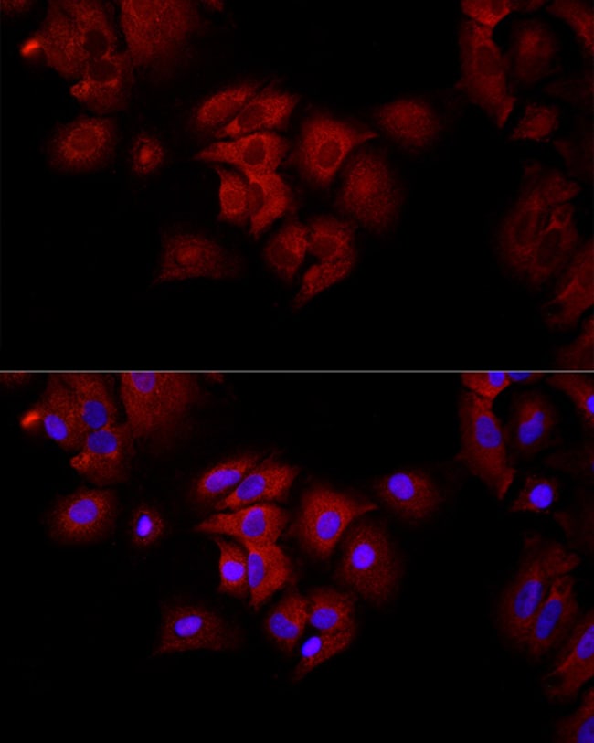 100UL FUMARASE ANTIBODY 100 ul