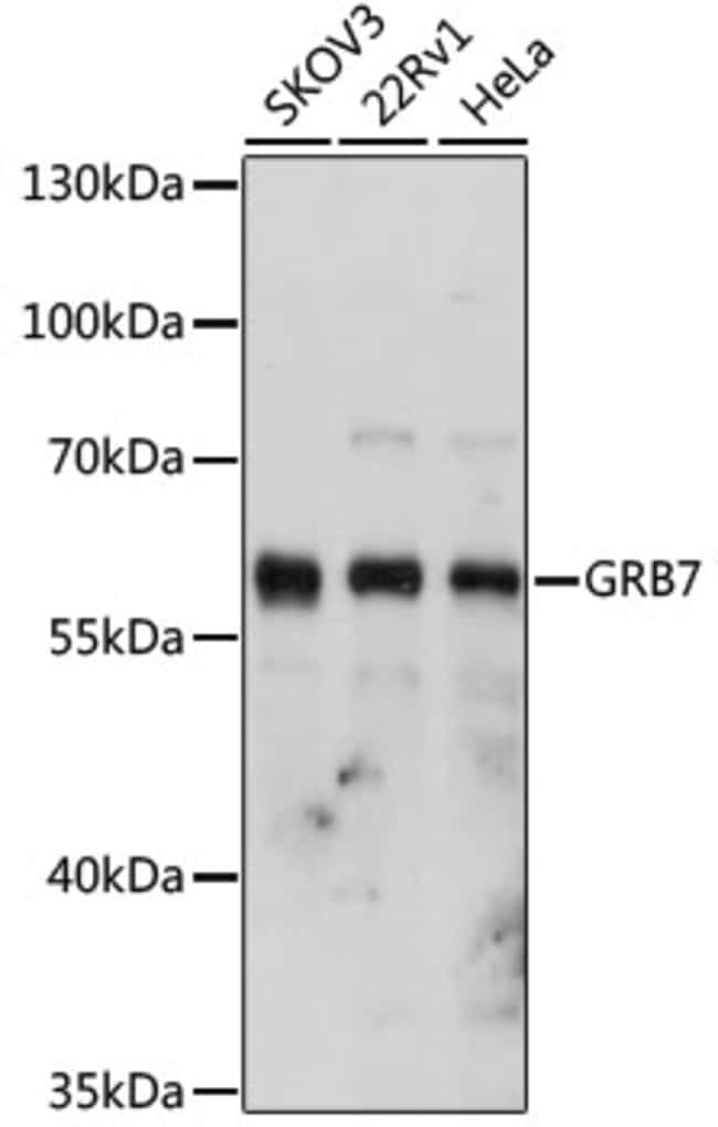 100UL GRB7 ANTIBODY 100 ul