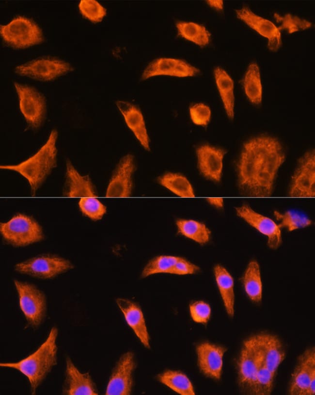 100UL GSTP1 ANTIBODY 100 ul