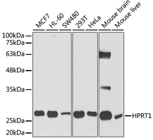 100UL HPRT1 ANTIBODY 100 ul