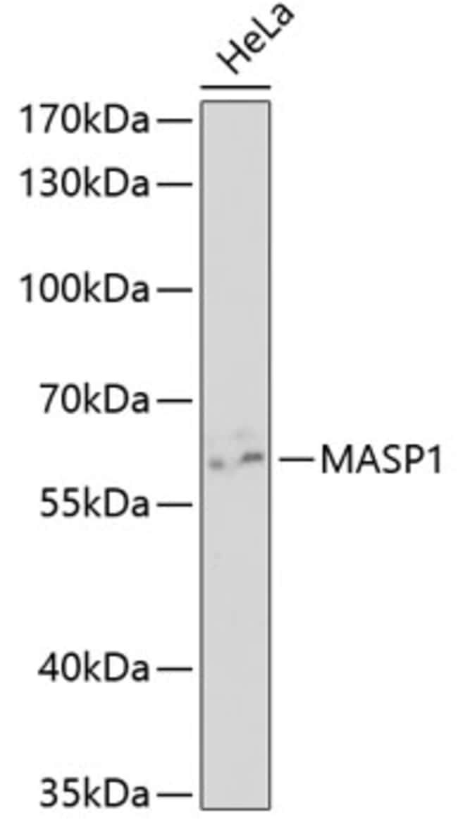 100UL MASP1 ANTIBODY 100 ul