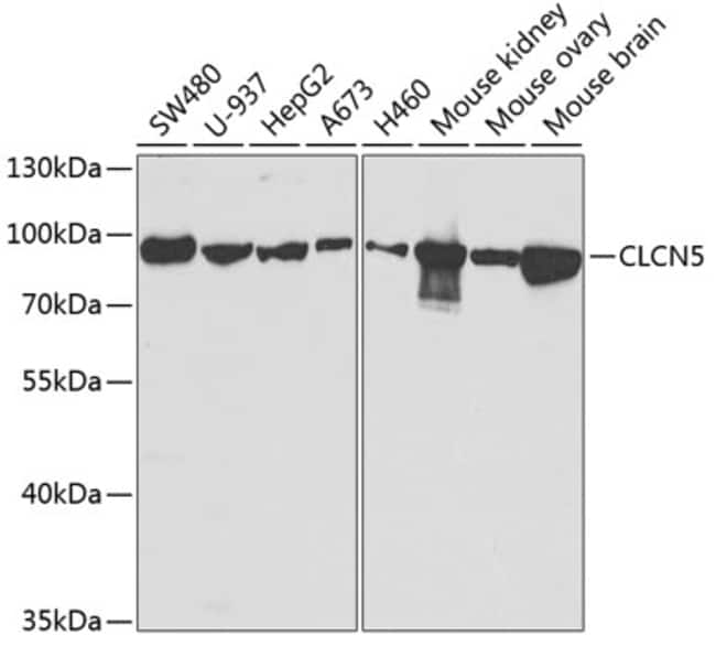 100UL CLC-5 ANTIBODY 100 ul
