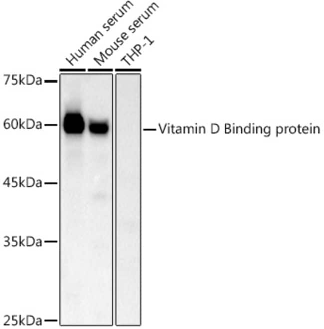 100UL GC ANTIBODY 100 ul