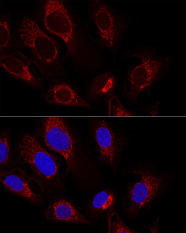 100UL CITRATE SYNTHASE ANTIBODY 100 ul