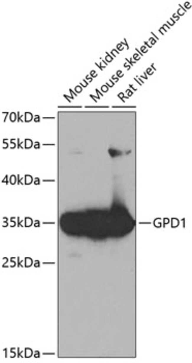 100UL GPD1 ANTIBODY 100 ul